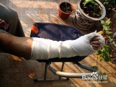 骨折愈合的时间