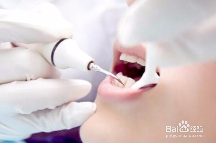 牙齿怎么祛黄变白?