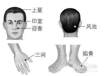 鼻窦炎的症状有哪些?