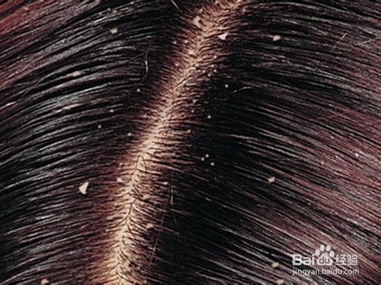 发质不好怎么办？头发问题怎么解决？