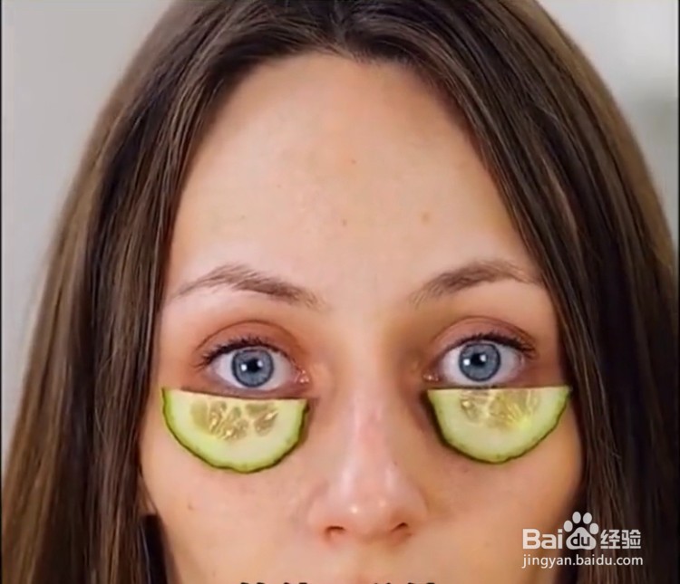 怎么消除黑眼圈