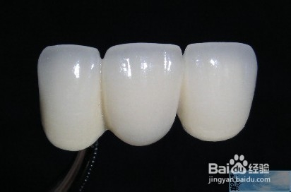 在要孩子的前一个月做烤瓷牙可以吗