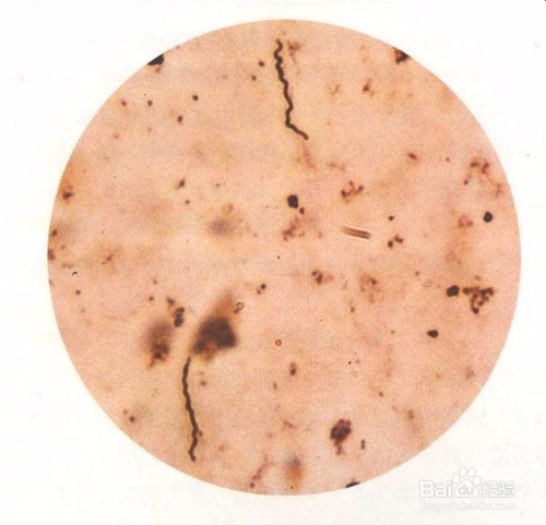 合理用药 首先运用长效抗生素,长效抗生素在梅毒螺旋体繁殖期起杀菌