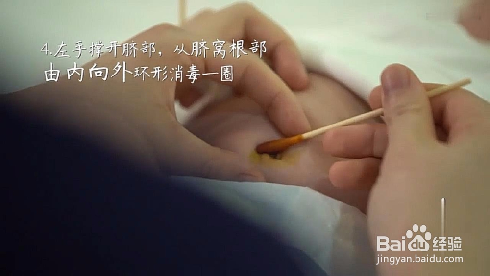 新生儿脐部的正确护理方法