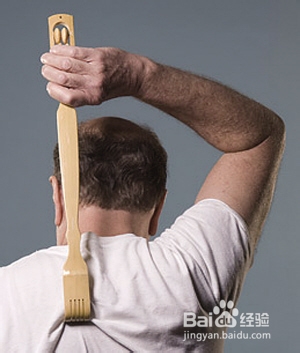 湿疹的危害有哪些