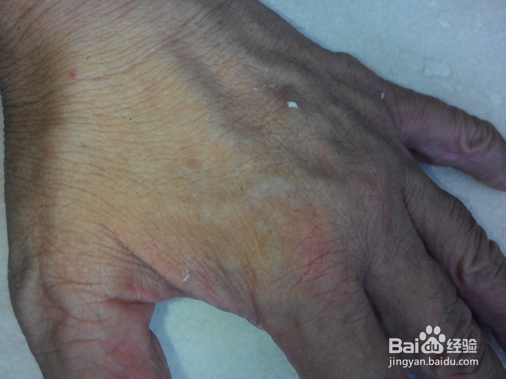 三伏烙饼炒鸡蛋-顺应节气身体好