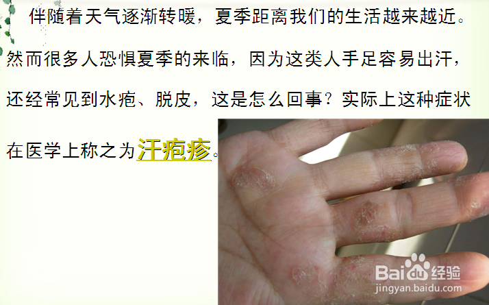 汗疱疹注意事项-百度经验