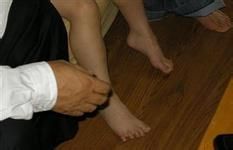 肌营养不良症的预防