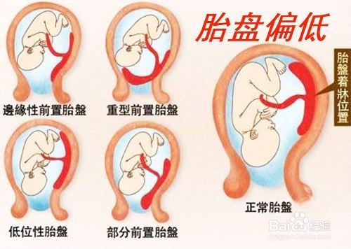 22周胎头位置低b超看不清头面部怎么办 百度经验