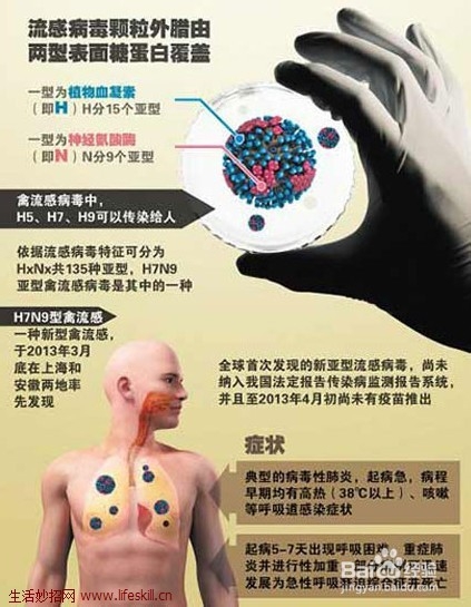 H7N9禽流感的发病症状