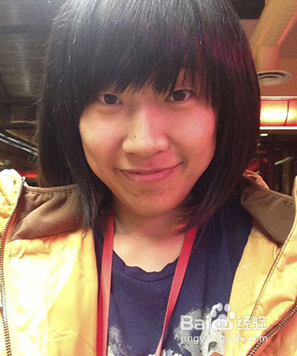 全切双眼皮效果很不错