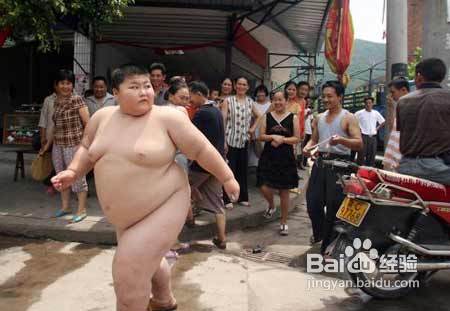 肥胖儿童减肥注意事项