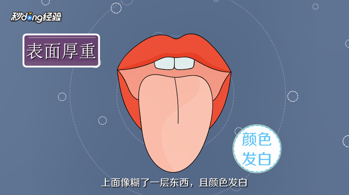 舌苔颜色各代表什么意思