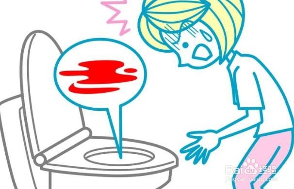 结肠癌的十大体征