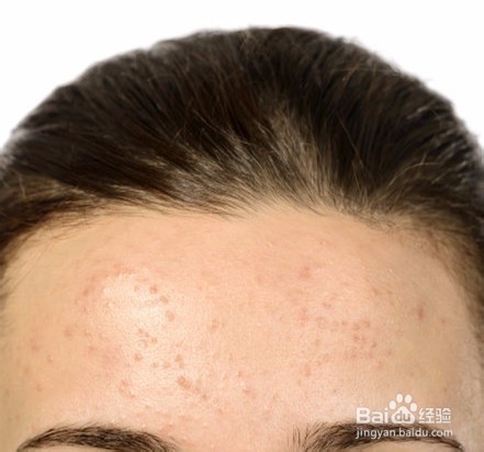 过敏性体质怎么办