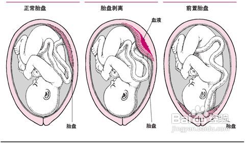 生命的奇迹——听妈妈讲自己出生时的惊险【孕准月】