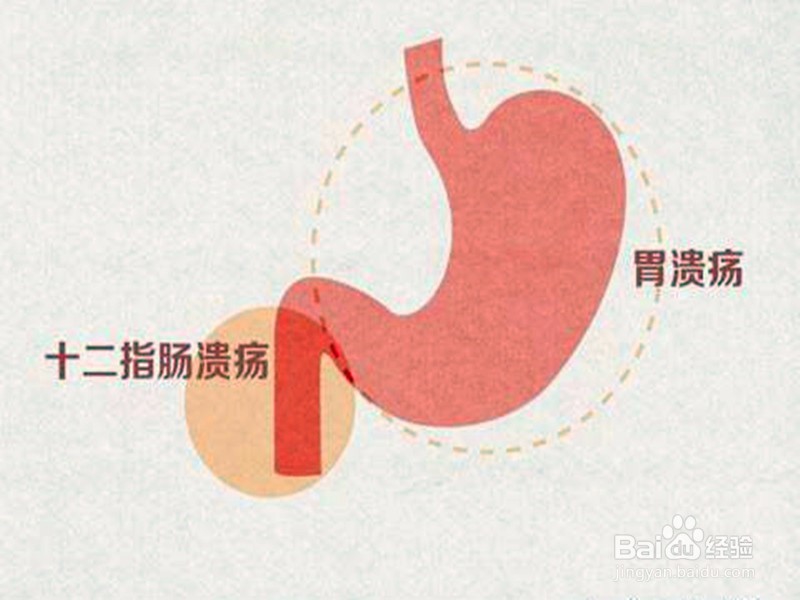 火锅涮羊肉4种人要注意，为什么？