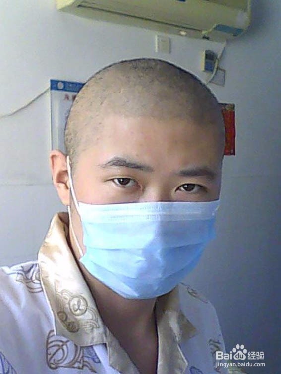 结直肠癌如何治疗，有哪些症状？