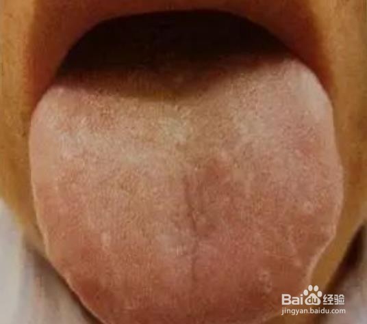 人参健脾丸与香砂六君丸的区别