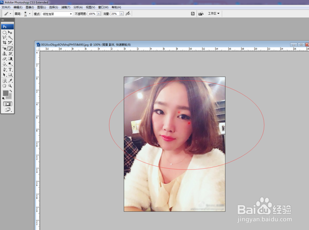如何去除脸上的痦子?