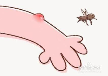 为什么蚊子喜欢咬我？什么样的体质易招蚊子?