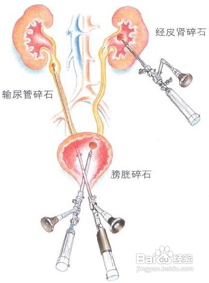 怎样让鼻子不再受伤?