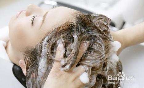 头皮屑怎么祛除