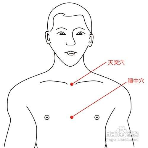 哮喘取穴天突,大椎,肺俞,定喘,郄门,剧烈咳嗽加尺泽,列缺,膻中,痰多加