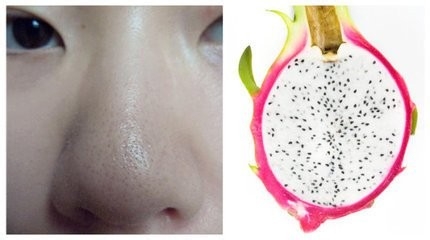 怎么去黑头？我有办法！！
