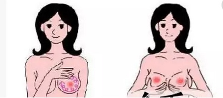 催乳师按摩6大关键穴位,搞宝妈大涨奶