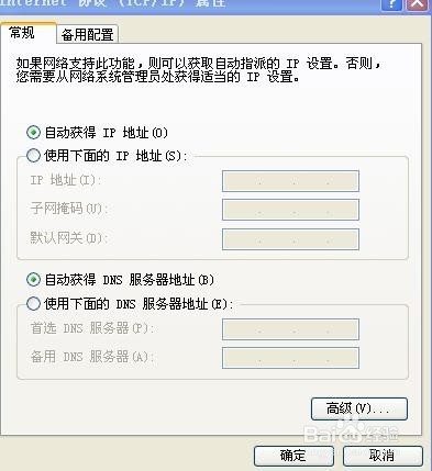 Xp如何变更网络配置