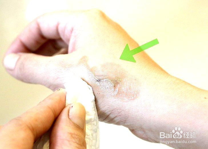 去除皮肤上的染料