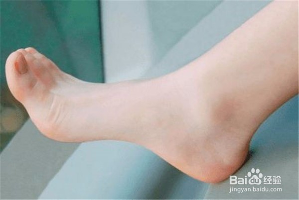 脚后跟皮肤开裂？5个方法解决你的问题! 真有用