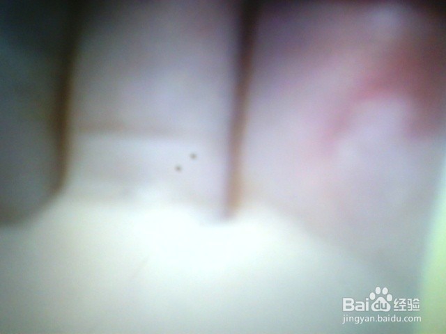 宝宝灼伤/烫伤，该怎么办？