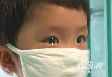 装修污染是儿童白血病罪魁吗