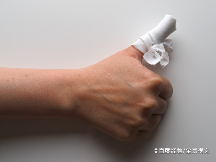 包扎方法有哪几种