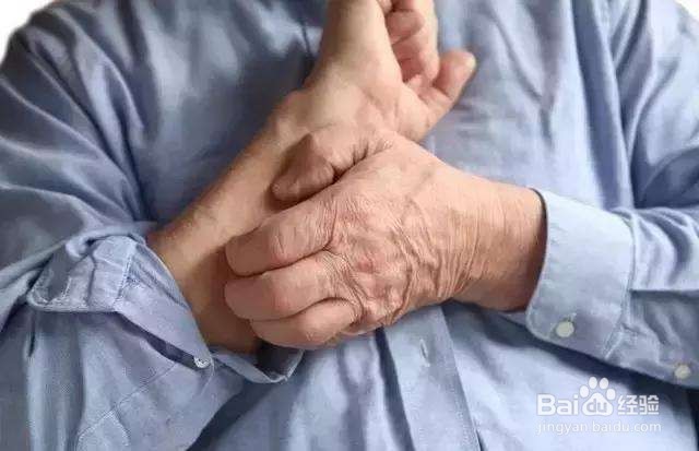 如何分辨湿疹和癣