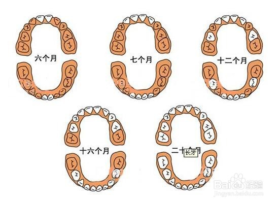 宝宝出牙时应做好哪些护理工作