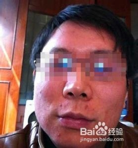 为什么喝酒脸会红