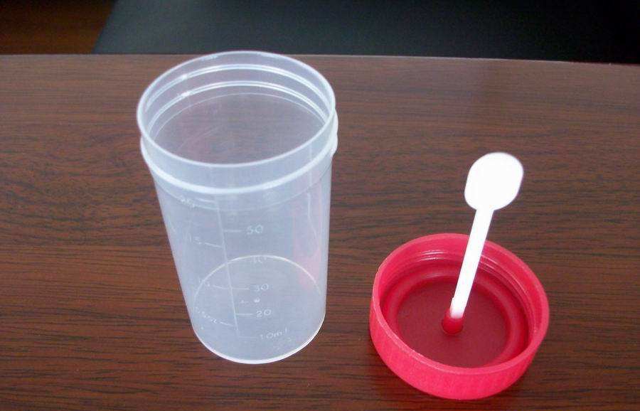 验大便怎么取样