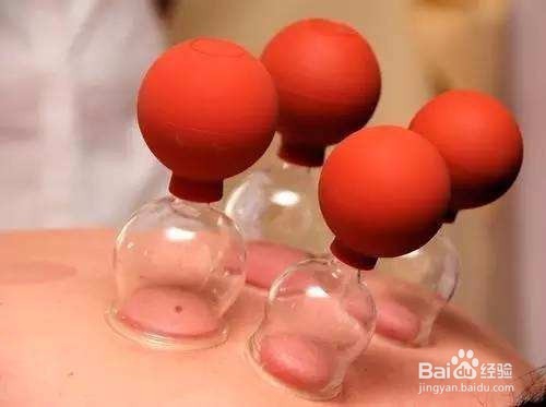 拔罐有什么讲究吗？