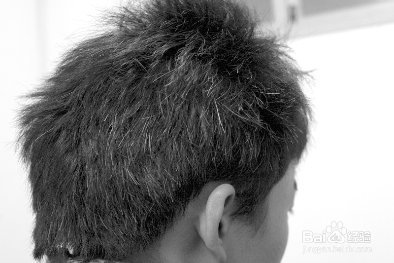 肾虚引起少年白怎么办