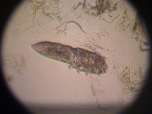 鼻子下面起泡速好方法