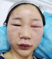 身体中哪些水中应该注意