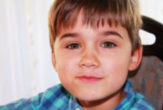 如何去除红血丝