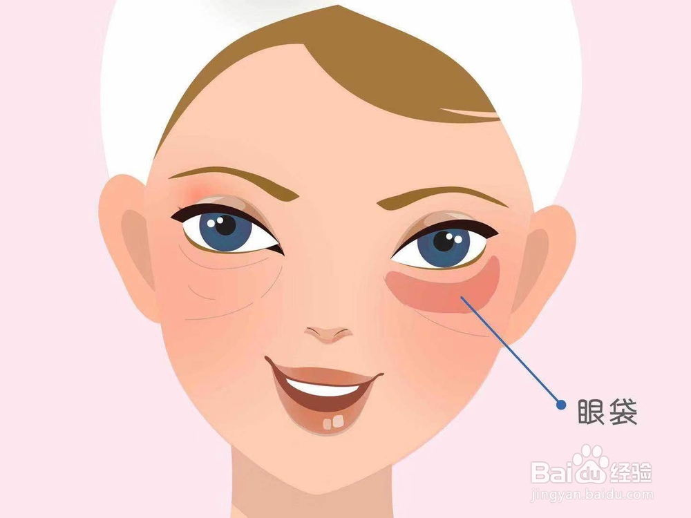 怎么祛除眼袋