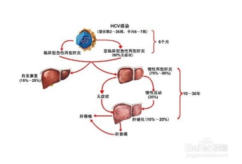 肝功能异常怎么办