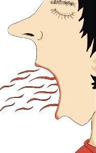 口臭的症状表现