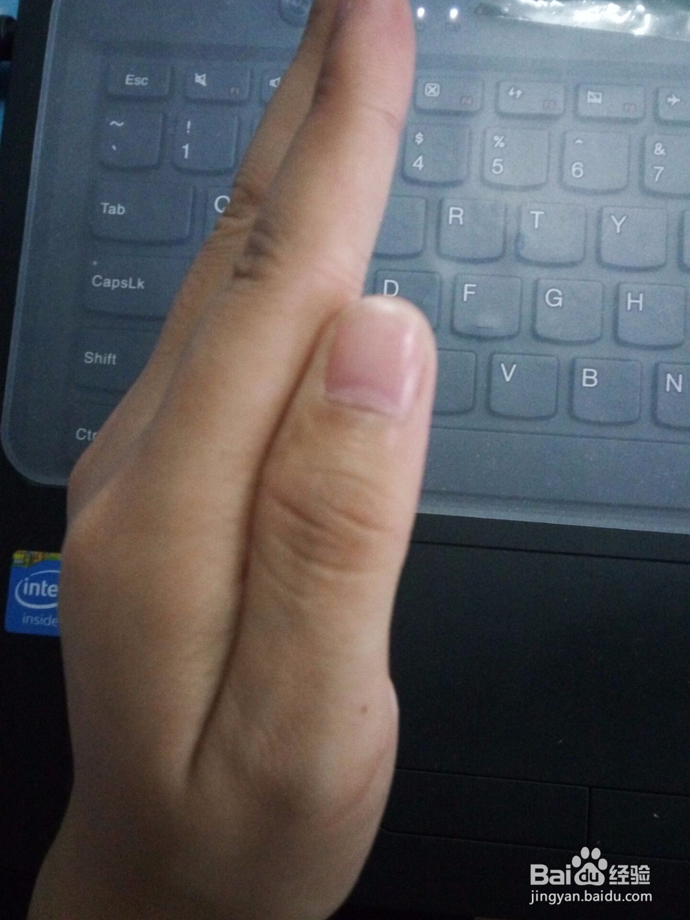 青年和青少年腰部日常保养与护理