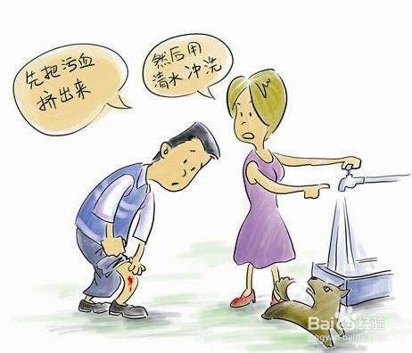 被狗咬伤后，怎么处理？